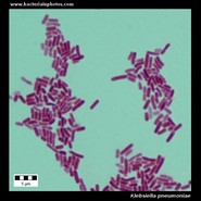 klebsiella pneumoniae under microscope